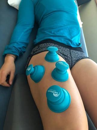 Wave Tool Riptide Sport Cupping Set